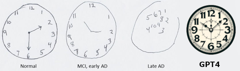 GPT4 Undertakes the MoCA Cognitive Test